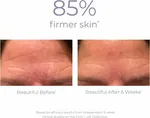 Derma E Firming DMAE Moisturizer with Copper Peptides GHK-Cu (56g) | Collagen & Elastin Support, Resveratrol Anti-Aging Cream Gallery Thumbnail 1