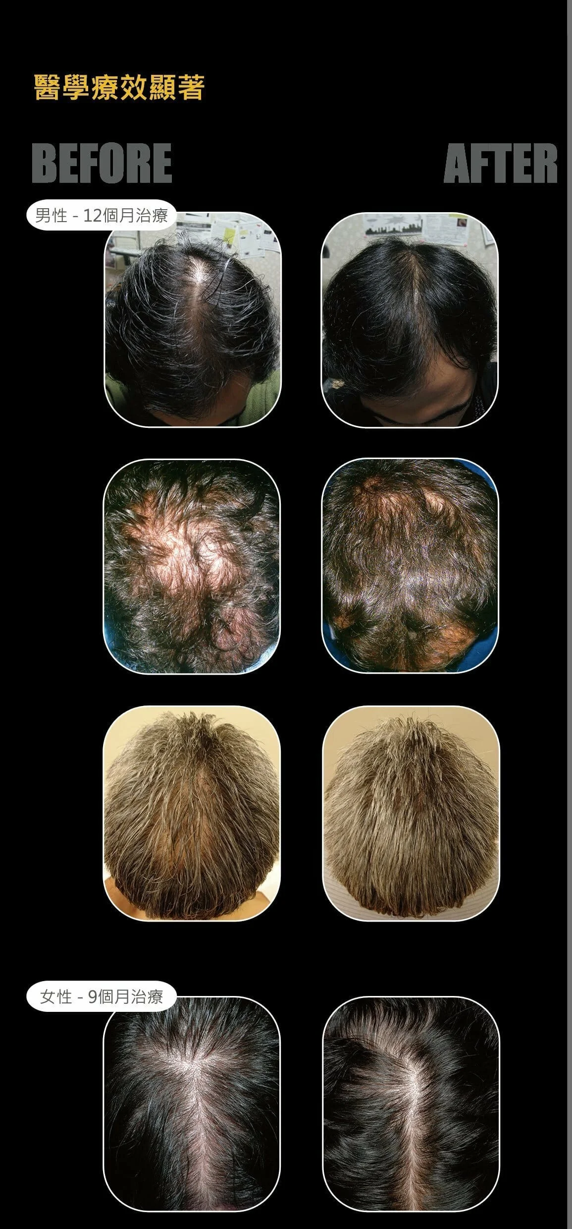 REVIVOGEN MD Scalp Therapy (30 days supply) (1 bottle) - Image 4